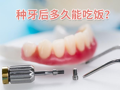 了解天津老年人种植牙要多少钱