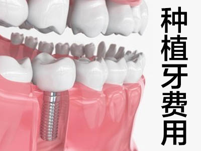 天津国产牙种植多少钱一颗 种植牙的费用