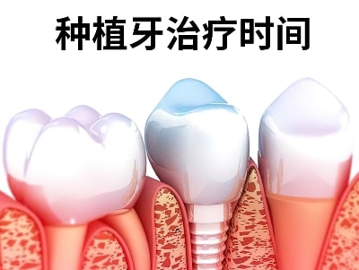 天津种植牙医院怎么选择天津治疗种牙去那家好