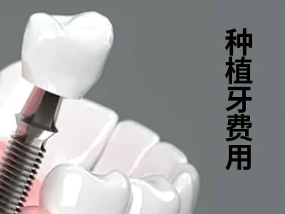 天津口腔医院种植牙的收费标准