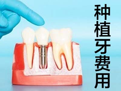 天津口腔医院种植一颗牙多少钱啊 天津种植牙医院哪家好