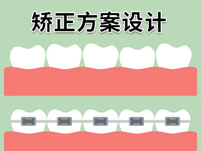 天津成年人矫正牙齿需要多少钱