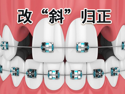 天津成年人做牙齿矫正多少钱