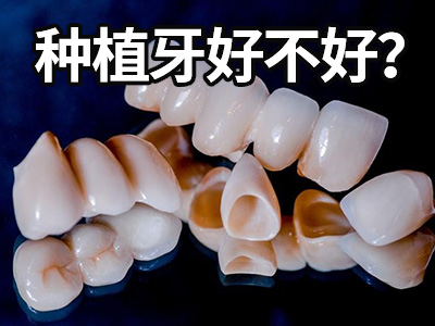 天津两颗门牙缺失做种植牙多少钱-种植一颗牙需要多少钱