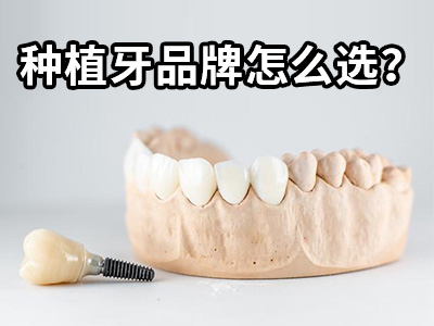 天津一般满口种植牙需要多少钱一颗-种植牙2022价格表