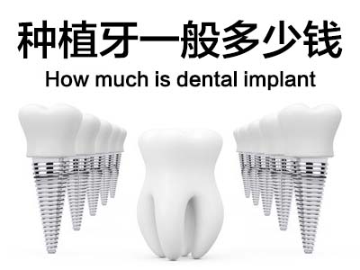 天津全口种植牙一般的费用 天津口腔医院排名