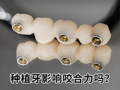 全口种植牙多少钱-天津全口种植牙的费用