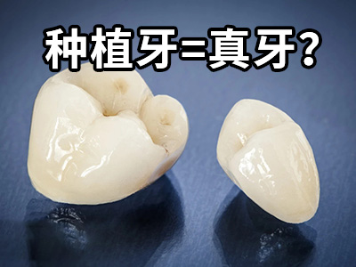 天津比较好满口种植牙医院-种植牙医院排名