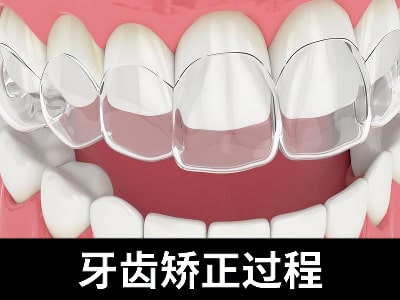 天津北辰医院牙齿矫正价格-畸形牙齿图片