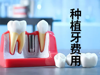 天津成人种植牙齿多少钱一颗-种植牙齿多少钱一颗