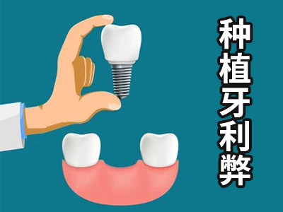 天津种植牙一颗门牙多少钱左右的？
