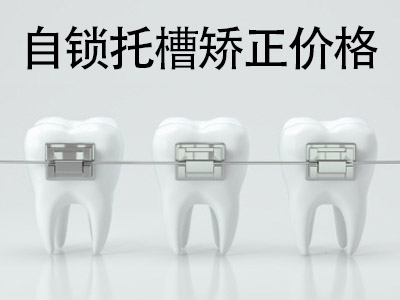 天津成人畸形牙齿矫正价格 牙齿矫正要多少钱
