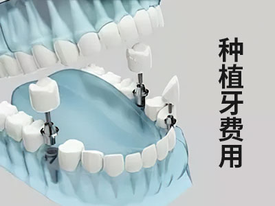 天津种植牙修复全过程费用-种植牙多少钱一颗