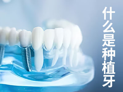 天津半口牙缺失种植修复方式-天津半口牙种植怎么种