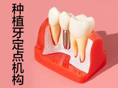 天津做种植牙哪里医院牙科好 种植牙怎么选择医院