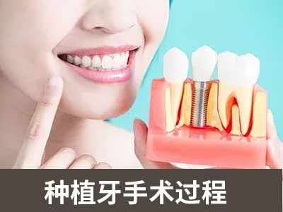天津半口牙种植大约要多少钱-种牙多少钱