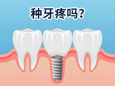 天津哪家医院的种植牙好需要多少钱