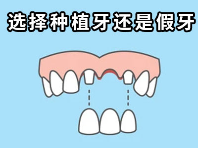 天津拔除智齿才能治疗牙周炎种植牙的价格