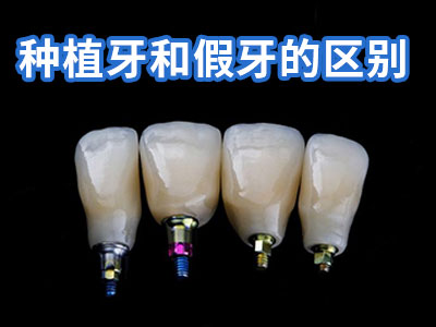 天津半口种植牙一般种几颗牙种植牙费用