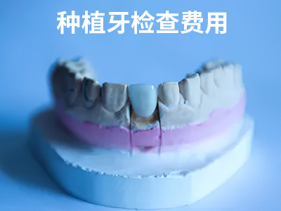 ALLON4-6种植牙-天津全口种植下颌牙种几颗