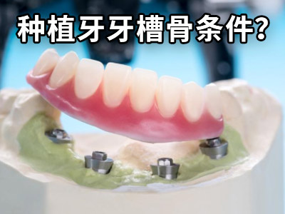 天津现在种一口种植牙要多少钱-天津植牙费用