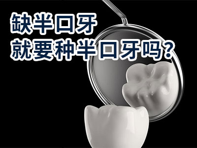 天津半口种植牙一般种几颗牙多少钱