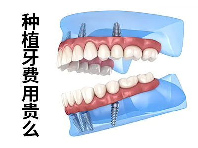 天津中诺口腔医院种植牙多少钱一颗牙