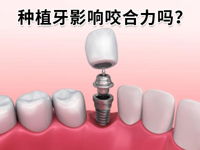 天津半口种植牙一般种几颗牙-天津种牙价格表2023年