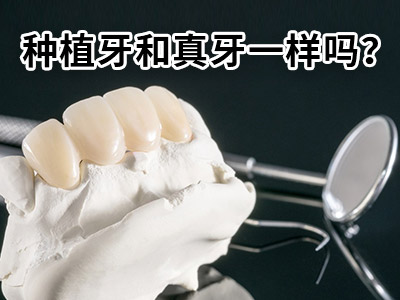 天津哪家牙科医院可半口种植牙-种植牙好的医院天津