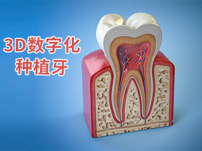 天津半口牙需要种植多少颗-种植牙费用天津