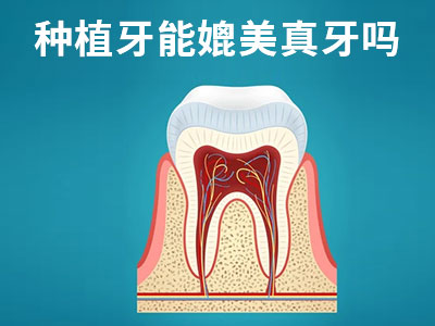 天津拔了牙种植一颗的费用要多少钱啊