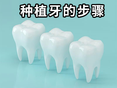 天津种植牙价格表已出-天津半口牙种植大约多少钱