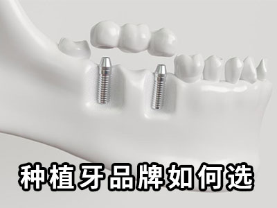 天津老人种植一颗牙的价格大约要多少钱