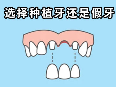 天津2023种植牙价格表-天津种植牙半口价钱一颗