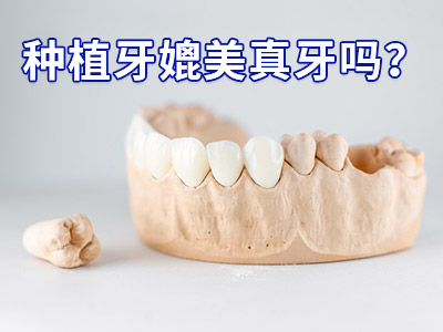 天津半口种植牙一般几个颗牙-半口种植牙天津需要种几颗