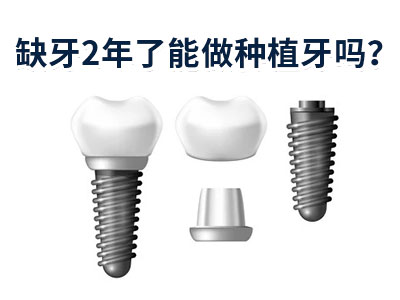 天津全口即种即戴种植牙价格要多少价格