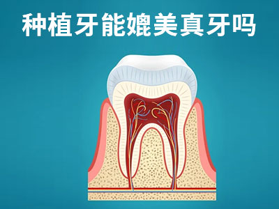 种植牙费用表2023天津-天津即刻半口种植牙大概多少钱