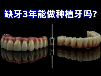天津半口种植牙一般指多少颗-天津种植牙一颗的费用