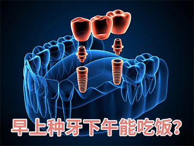 天津半口种植牙哪家做得好?天津种植牙哪家医院比较好