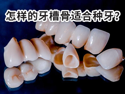 天津全口种植牙是种几颗牙-天津全口种植牙多少钱