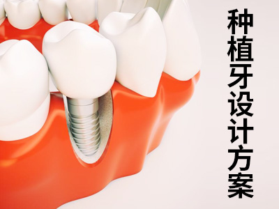 天津中诺口腔医院3d数字化微创种植牙