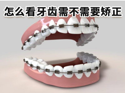 天津中诺口腔医院畸形牙齿不齐矫正价格