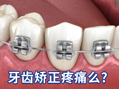 天津中诺口腔医院牙齿做畸形矫正多少钱一次