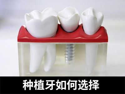 天津中诺口腔医院半口种植牙价格是多少