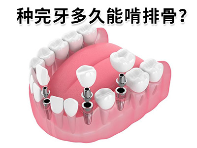 天津中诺口腔医院全口牙种植牙即拔即种即用费用是多钱