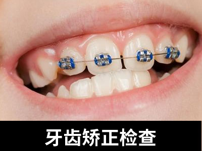 天津中诺口腔医院31岁成人矫正牙齿多少钱