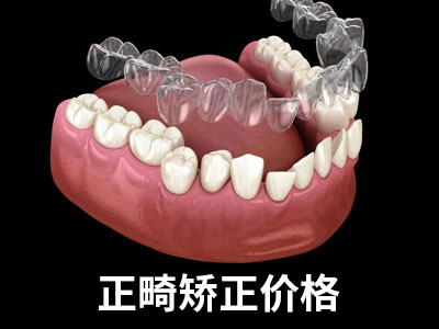 天津中诺口腔医院成人龅牙牙齿矫正大概多少钱