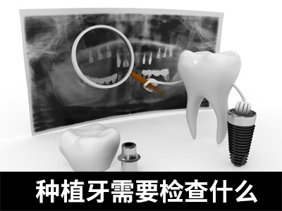 天津中诺口腔医院种植半口牙得多少钱