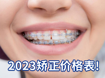 天津中诺口腔医院儿童门牙牙齿矫正价格