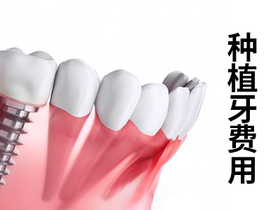 天津中诺口腔医院全口牙种植要种多少钱